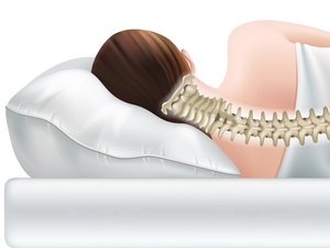 Illustration einer ungesunden Krümmung der Halswirbelsäule bei falscher Schlafposition auf einem zu hohen oder weichen Kissen